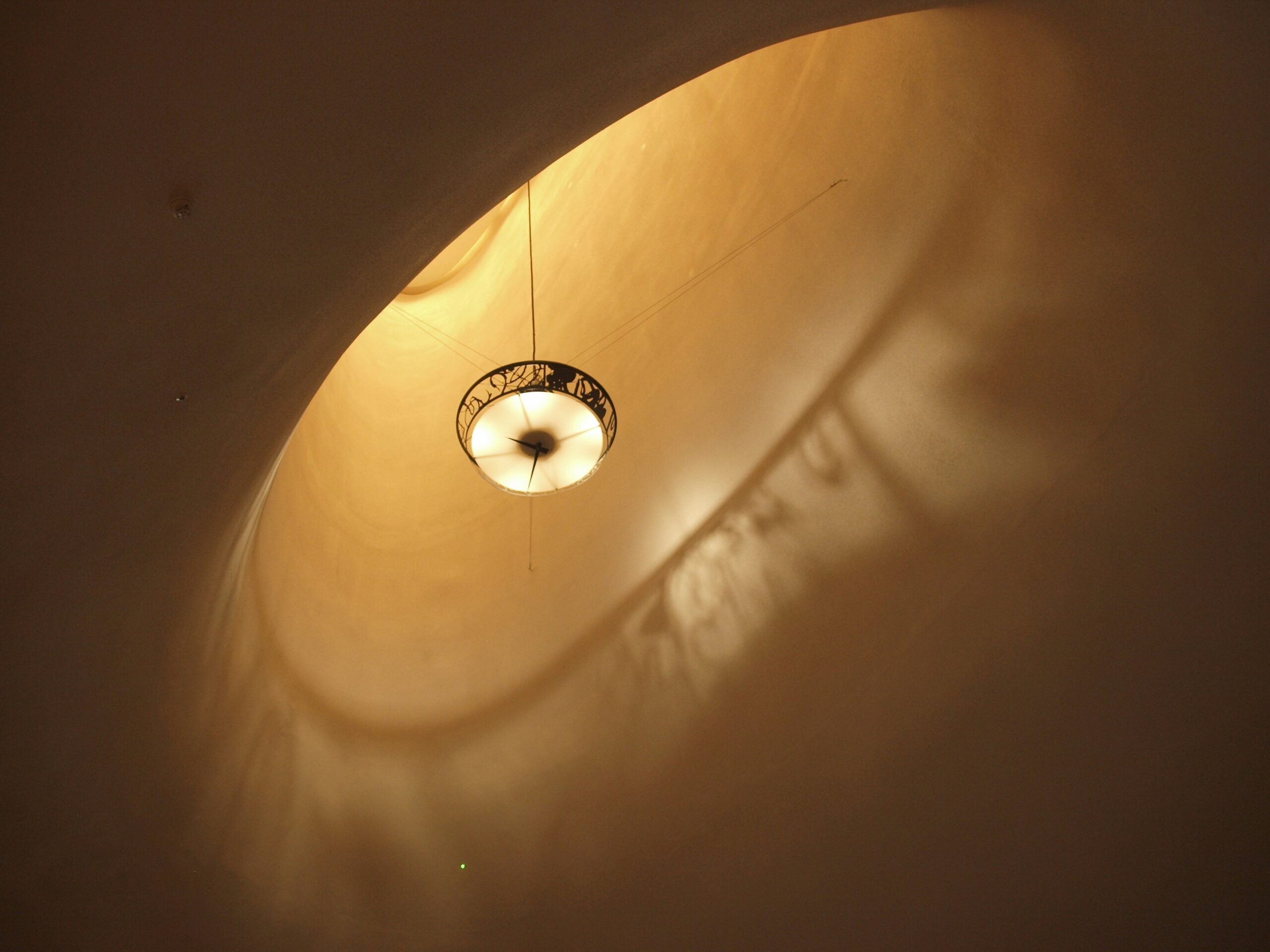 Glaucoma Surgery