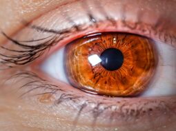 Refractive Cataract Surgery